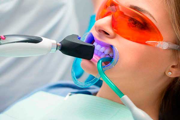 clinica blanqueamiento dental zaragoza